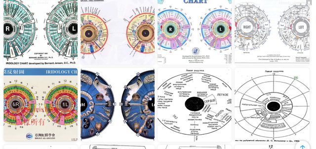 Gallery of iridology charts from American, Chinese and Russian authors.