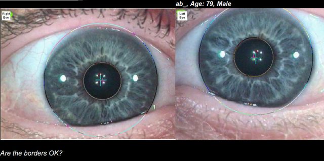 Grey-blue irises with pupil centres marked and the prompt: Are the borders OK?