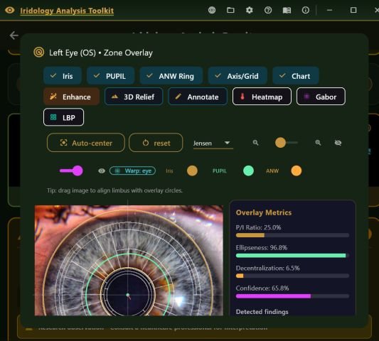 Zone overlay screen with iris, pupil and nerve wreath rings fitted to a photograph, Jensen chart selected, and overlay metrics.